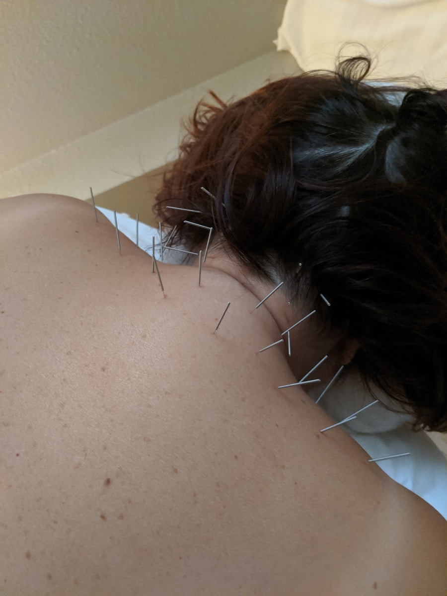 image-2 Photo "Why is acupuncture (spiritual) dangerous according to the Bible, and why ask Jesus for help instead?"